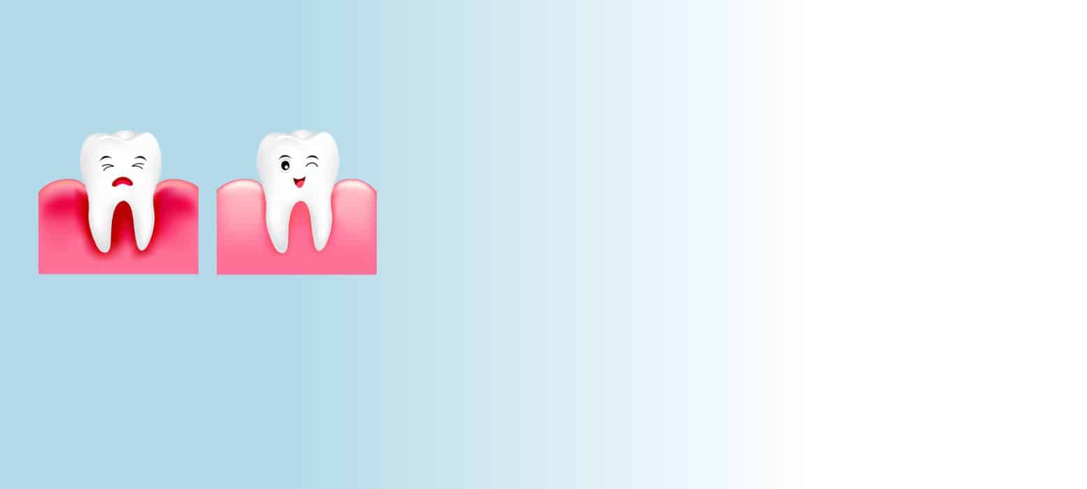 Tipps gegen entzündetes Zahnfleisch