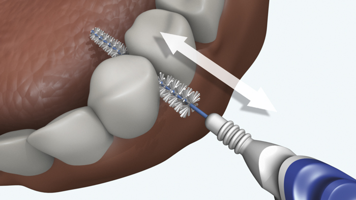 Brossette interdentaire: Pourquoi l'utiliser? Comment? Laquelle?